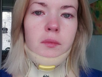 «Без корсета шия не тримається», - лучанка благає про допомогу