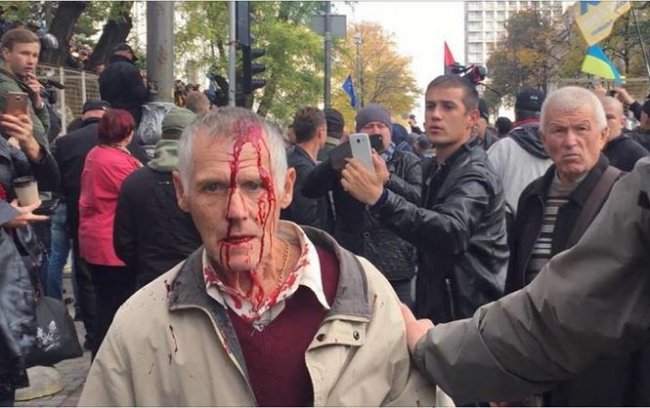 Постраждалий мітингувальник