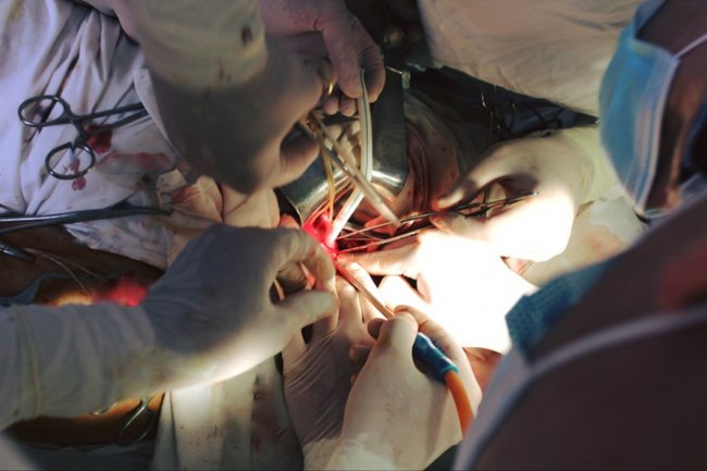 Волинські лікарі врятували пацієнта із гангреною. ФОТО