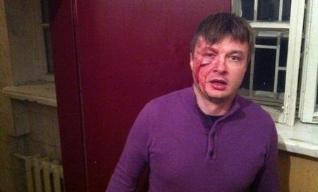 У Києві побили нардепа Іллєнка та його адвоката. ФОТО