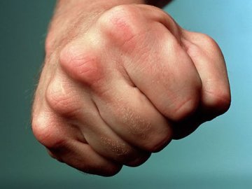 На Волині чоловік побив екс-дружину