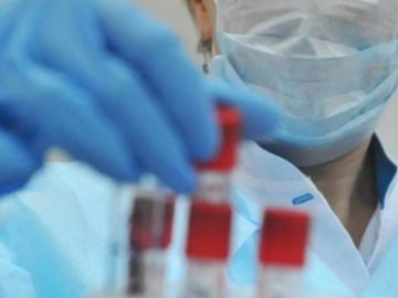 На Волині за минулу добу – 18 випадків ковіду 