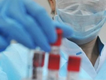 В Україні за добу – 917 нових випадків коронавірусу, на Волині – 67