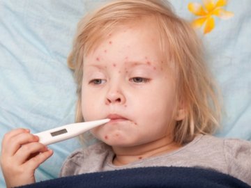 На Волині через кір закрили 9 шкіл