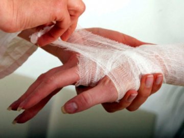 На Волині медики «швидкої» рятували трьох людей з опіками