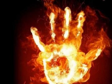 На Волині під час пожежі врятували 21-річного хлопця, потерпілий з опіками – у лікарні