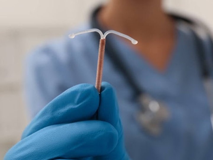 Гормональна спіраль: ефективний засіб контрацепції