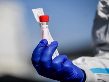 Повідомили статистику щодо COVID-19 в Україні за останню добу