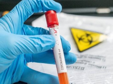 Де на Волині виявили нові випадки коронавірусу станом на ранок 5 вересня 