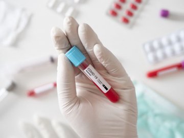 Повідомили кількість нових хворих на коронавірус в Україні загалом і на Волині зокрема