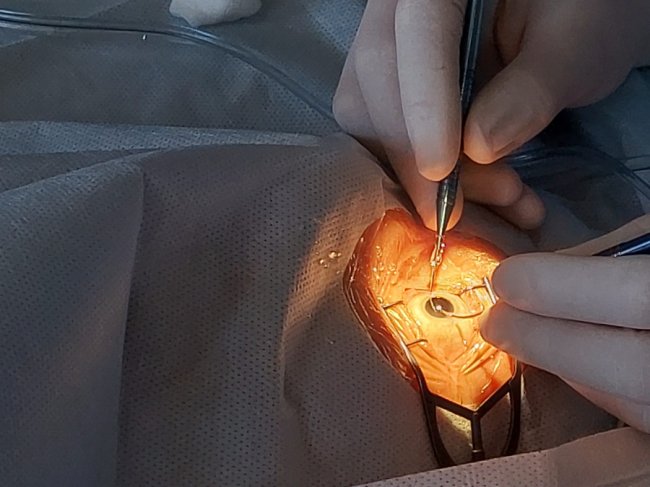 Волинські лікарі днями відновили зір 13 людям. ФОТО