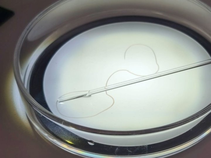 У 57-річного волинянина виявили паразитарне захворювання, яке передається через укуси комарів