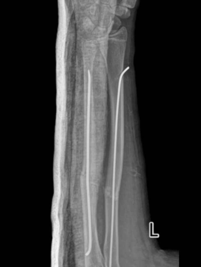 На Волині лікарі зробили унікальну операцію без жодного розрізу. ФОТО