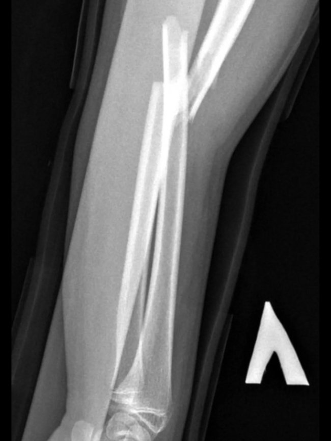 На Волині лікарі зробили унікальну операцію без жодного розрізу. ФОТО