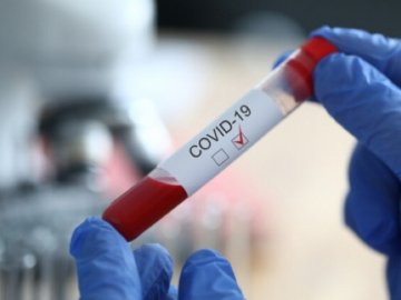 На коронавірус захворіла працівниця Любешівської РДА: у районі діє низка обмежень  