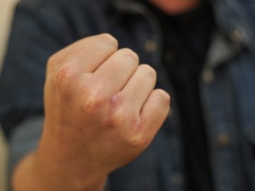 Волинянина, який побив та обікрав рибалку, взяли під варту