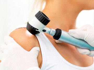 У центрі Луцька медики безплатно обстежуватимуть родимки