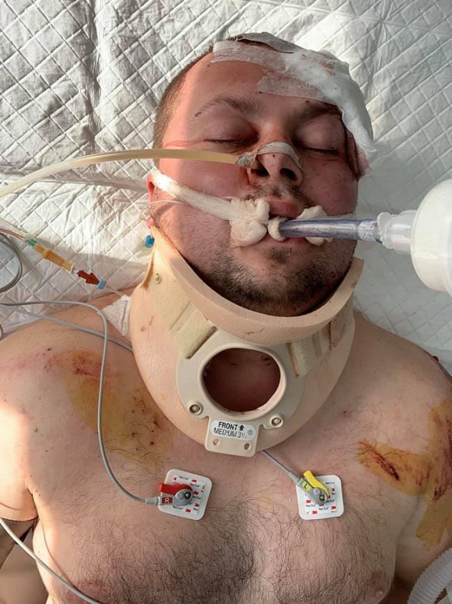 Волинянин після ДТП потребує коштів на лікування