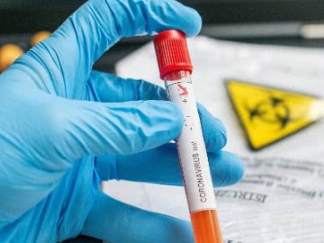 В Україні – 15 648 випадків COVID-19, з них за останню добу – 416 