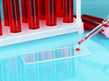 Чи можна здавати кров після вакцинації: пояснення МОЗ