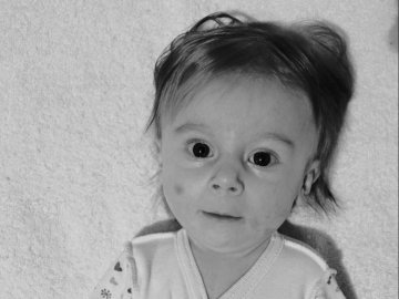 Померла маленька волинянка, якій збирали понад 2 мільйони доларів на укол