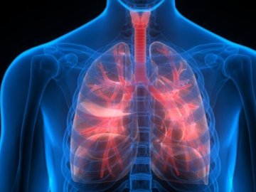 На Волині значно побільшало хворих на пневмонії