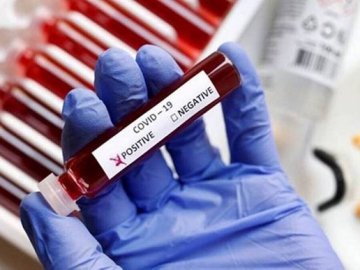 За добу на Волині зафіксували понад 200 нових випадків коронавірусу