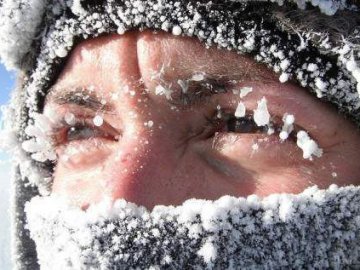 Луцька лікарка розповіла, як відрізнити обвітрювання шкіри від холодової алергії