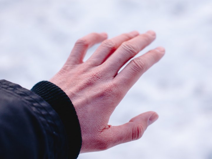 18-річний волинянин обморозив пальці