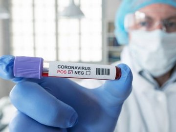 Ранок 10 травня: в Україні –  15 232 випадки коронавірусу, на Волині – 470