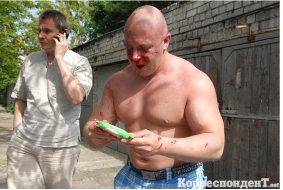 Як били лідера гей-форуму України. ФОТО