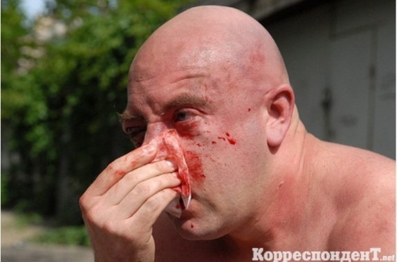 Як били лідера гей-форуму України. ФОТО