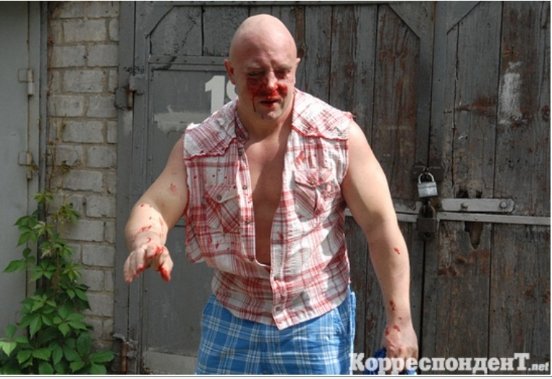 Як били лідера гей-форуму України. ФОТО