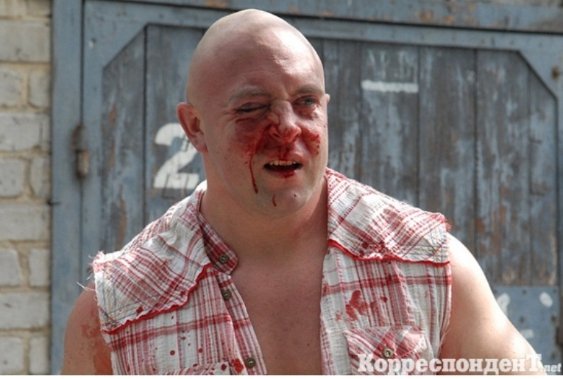 Як били лідера гей-форуму України. ФОТО