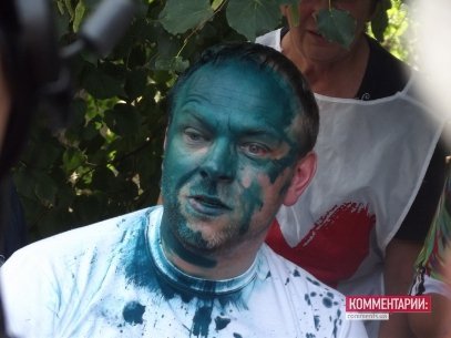 Як зеленкою «лікують» політиків. ФОТО