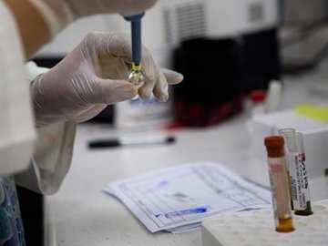 Підозра на менінгококову інфекцію у луцького школяра не підтвердилась