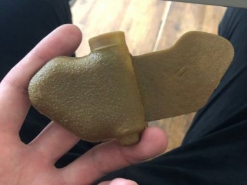 У Запорізькій області троє дітей підірвалися на боєприпасі