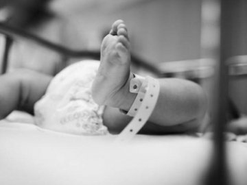 Померли сіамські близнюки, які нещодавно народились у Чернівцях