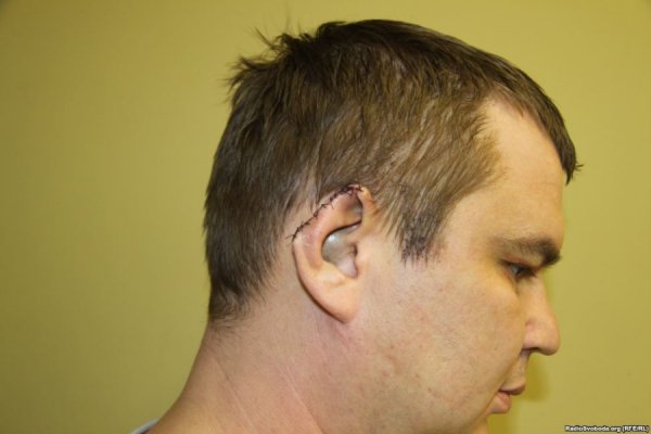 Відрізане вухо, проколи на руках, ‒ катування Булатова. ФОТО