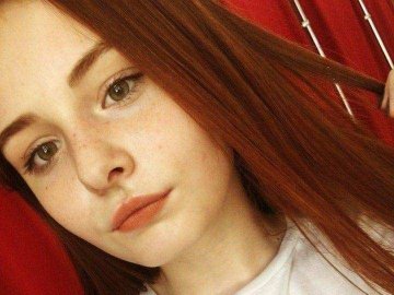 16-річна дівчина з Волині важко захворіла: рідні благають про допомогу