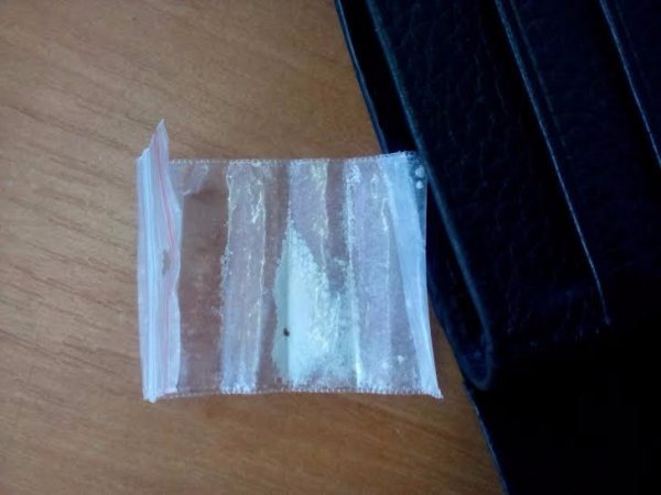 На Волині затримали зловмисника, що перевозив наркотики у власному шлунку. ФОТО