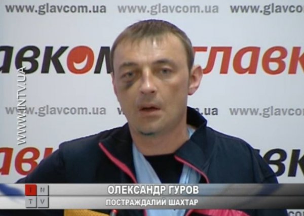 Татуювання «Слава Україні!» терористи зрізали розбитою лампочкою. ФОТО