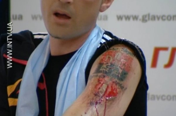 Татуювання «Слава Україні!» терористи зрізали розбитою лампочкою. ФОТО