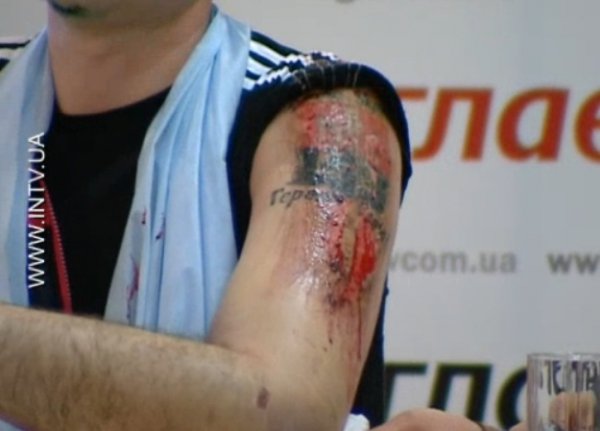 Татуювання «Слава Україні!» терористи зрізали розбитою лампочкою. ФОТО