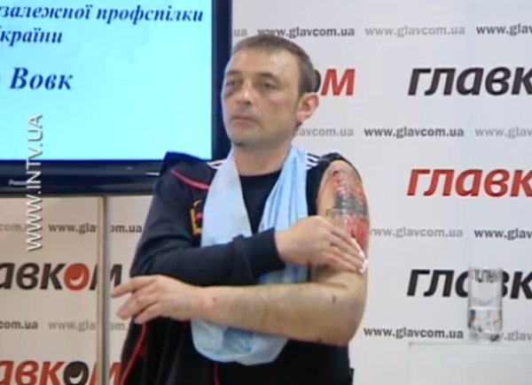 Татуювання «Слава Україні!» терористи зрізали розбитою лампочкою. ФОТО