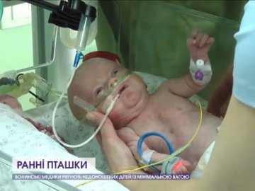 У Луцьку медики врятували 420-грамове немовля. ВІДЕО