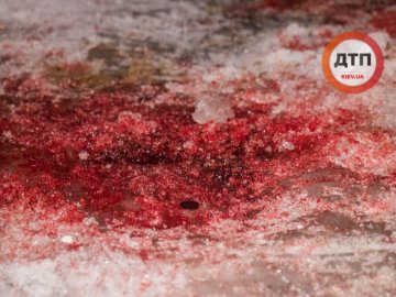 Поранив поліцейського, а згодом і себе: у Києві чоловік зі зброєю пограбував магазин. ФОТО