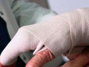 У Луцьку чоловік ремонтував автівку і обморозив руку. ФОТО