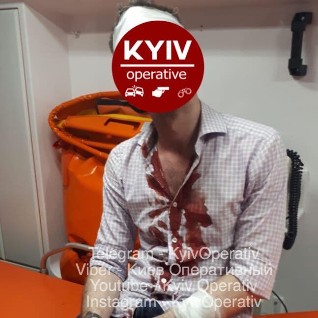 У Києві п’яний чоловік шаблею поранив перехожого