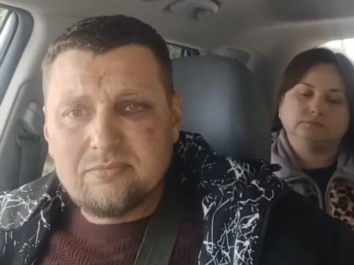 На Волині ветеран звернувся до поліції через побиття працівниками ТЦК